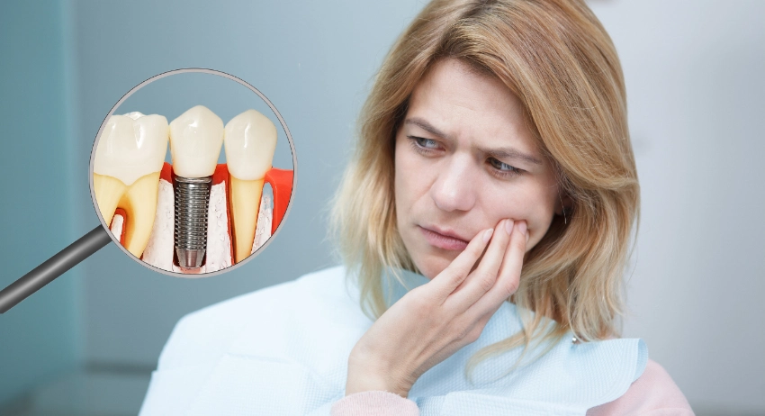 moi-nho-rang-co-trong-implant-duoc-khong2-1747645361.png