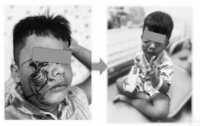Cẩn trọng khi chăm sóc, bảo vệ trẻ trong dịp hè