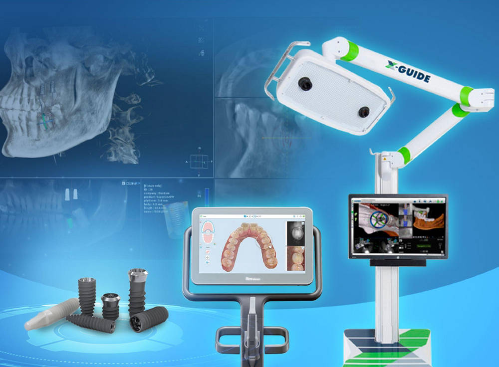 trong-rang-implant-co-thuc-su-dat-1753182894.png