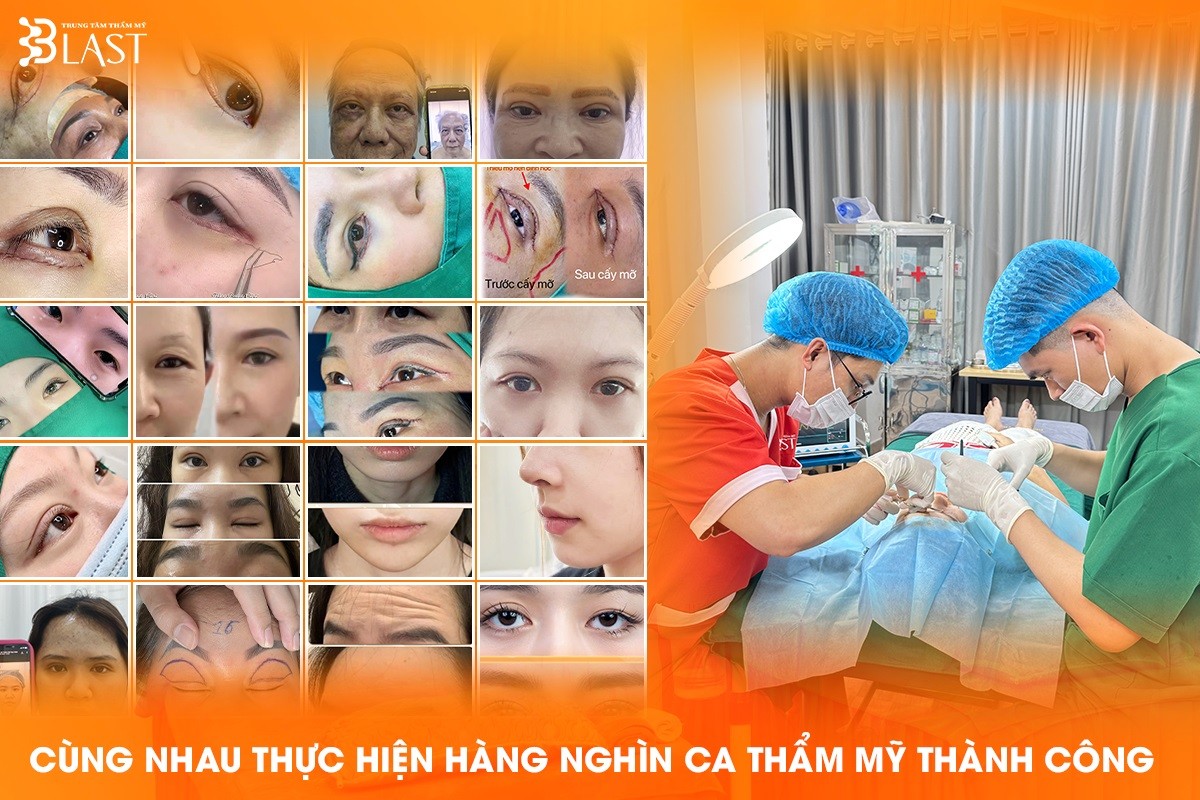 tham-my-blast-hai-phong-hang-ngan-ca-thanh-cong-1760955400.jpg