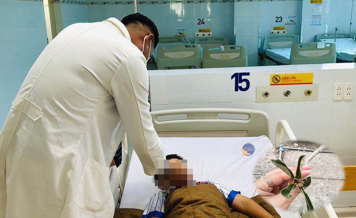 mu-hoa-su-gay-roi-loan-nhip-tim-hai-tre-nhap-vien-cap-cuu-1776864707.JPG