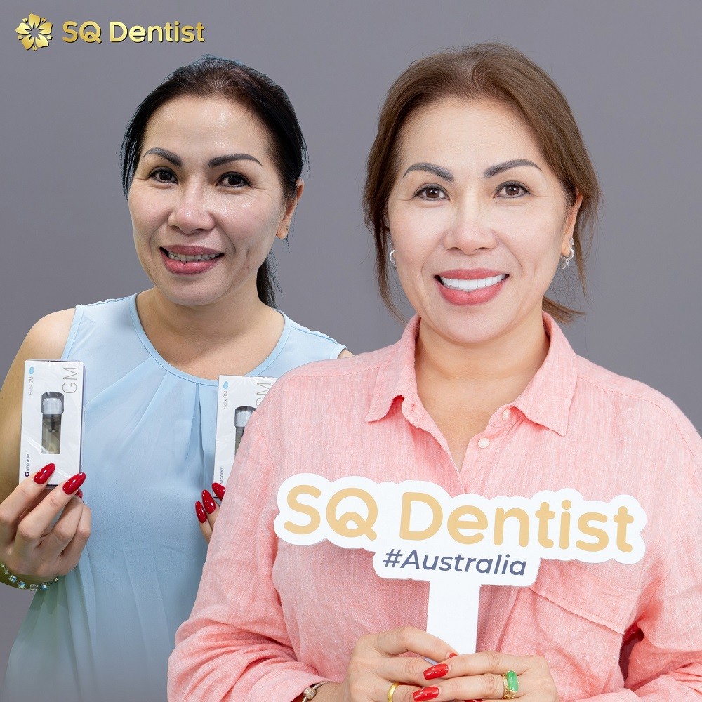 chon-tru-implant-uc-sq-dentist-1778750275.jpg