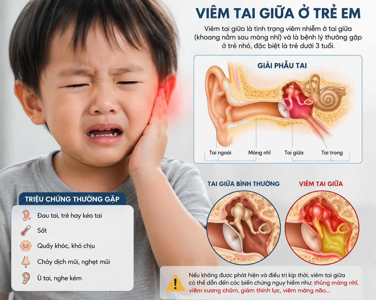 viem-tai-giua-de-tai-phat-co-the-gay-suy-giam-thinh-luc-neu-chu-quan-1-1780117967.png