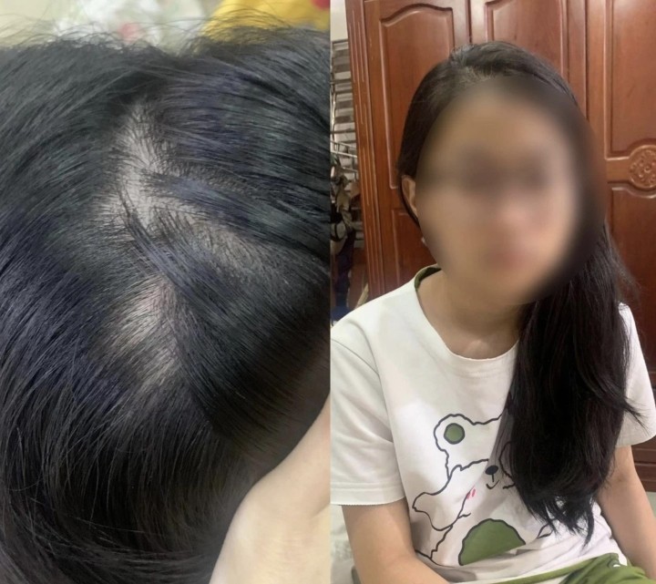 Người mẹ bạo hành con gái ruột ở TP.HCM khai gì?