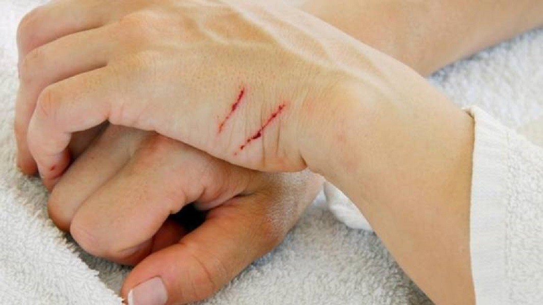 Những điều cần biết về thú cưng nuôi trong gia đình (Kỳ 3): Cảnh giác cao độ với các loại bệnh dễ lây nhiễm từ thú nuôi