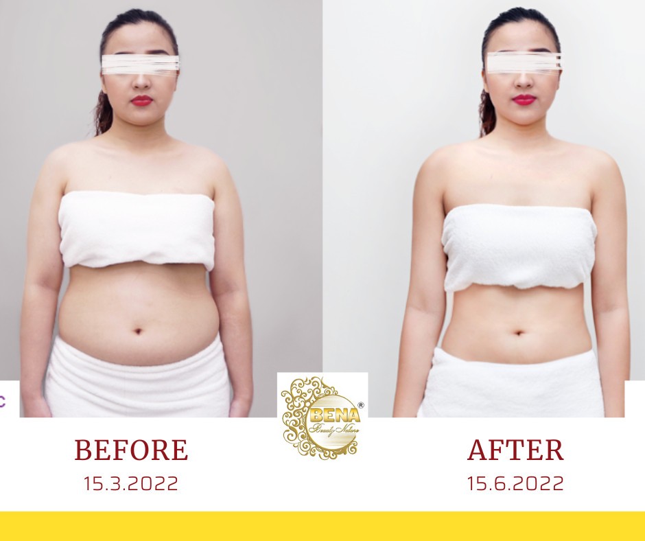 Thẩm mỹ viện giảm béo uy tín tại Quảng Ngãi