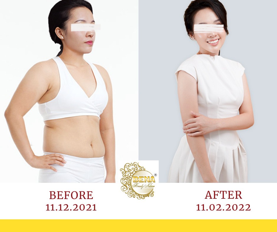 Thẩm mỹ viện giảm béo uy tín tại Hội An