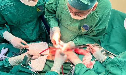 Giải cứu quả thận ‘chết đuối’ nhờ ca phẫu thuật loại bỏ khối u bàng quang khổng lồ
