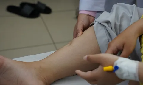 Ngày càng nhiều người trẻ mắc suy thận: Cảnh báo từ lối sống 'độc hại' hiện đại