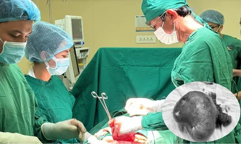 Bóc tách thành công khối u xơ tử cung lớn như thai 20 tuần