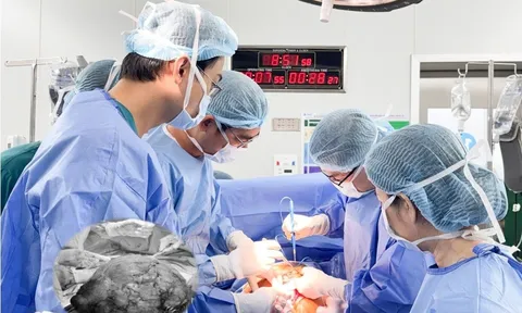 Hiếm gặp: U xơ tử cung gần 12 kg ở phụ nữ 25 tuổi