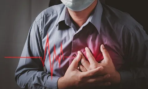 Loạn nhịp tim – bệnh lý âm thầm nhưng có thể gây đột tử