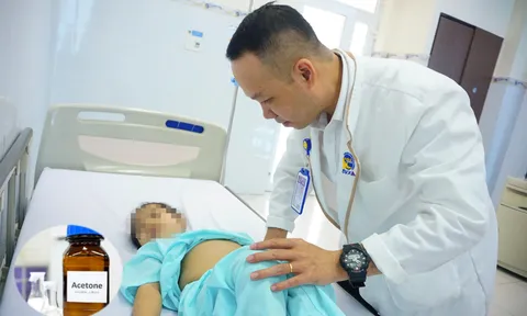 Cảnh báo ngộ độc aceton ở trẻ nhỏ: Nguy hiểm từ vật dụng quen thuộc