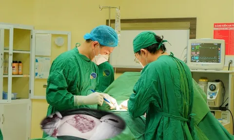Khối u không đau, người phụ nữ phát hiện ung thư vú khi đi khám