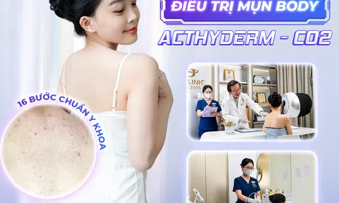 Acthyderm - CO2: Công nghệ trị mụn chuẩn y khoa giúp da khỏe đẹp từ bên trong