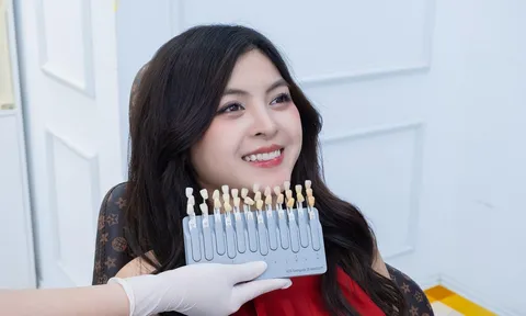 Vì sao có người thẩm mỹ răng sứ 10 năm vẫn đẹp, có người vài năm đã phải làm lại?