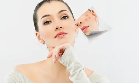Sau khi mụn giảm, vì sao nhiều người vẫn gặp tình trạng da yếu và dễ tái phát?