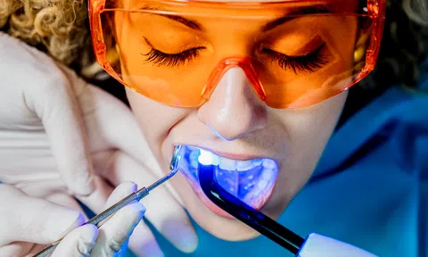Công nghệ tẩy trắng răng hiện đại tại Nha Khoa Đăng Lưu