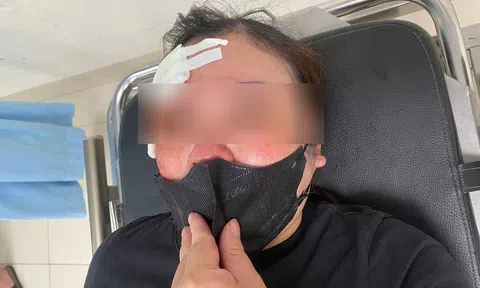 Người phụ nữ "tố" bị tài xế bán tải hành hung giữa phố ở Hà Nội: Công an vào cuộc xác minh