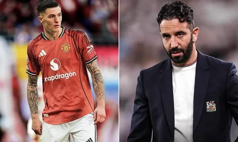 Ruben Amorim có thay đổi bước ngoặt, Man United lột xác ở trận gặp Man City