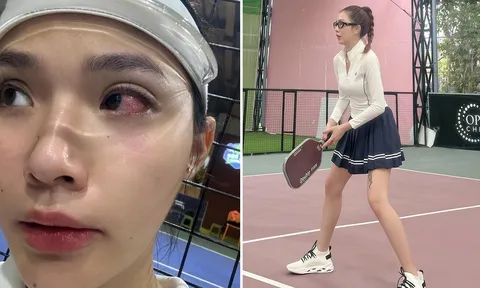 Bị đối thủ nam cố tình đánh bóng pickleball trúng mặt, dàn hot girl đồng lòng nói thẳng cách xử lý
