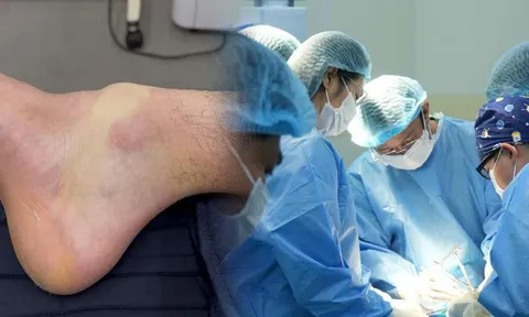 Nam thanh niên 32 tuổi dính chấn thương khi chơi pickleball, kết quả chụp MRI gây ngỡ ngàng