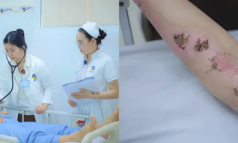 Tình hình hiện tại của cô gái bị sét đánh dẫn đến xuất huyết não? Bác sĩ chỉ cách tránh sét khi trời giông