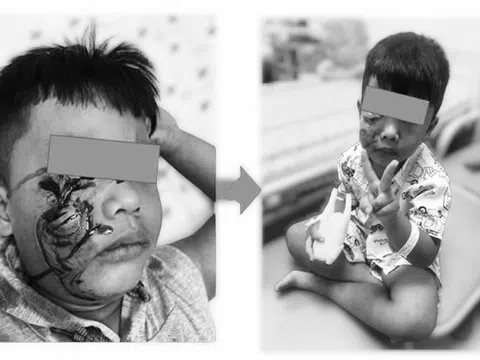 Cẩn trọng khi chăm sóc, bảo vệ trẻ trong dịp hè