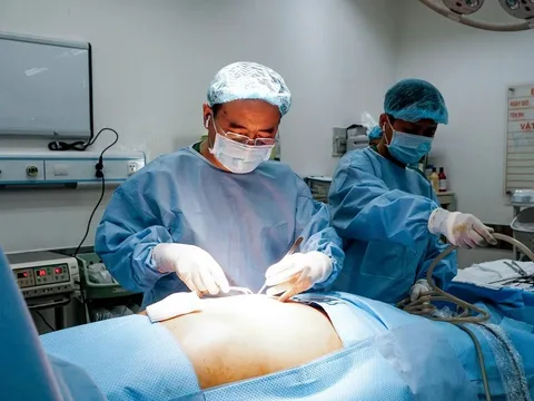 Cắt bỏ khối u dạ dày khổng lồ, bệnh nhân 49 tuổi hồi phục sau một tuần