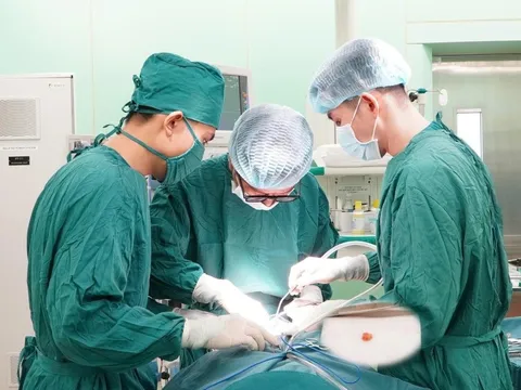 Sưng đau vùng hàm, người phụ nữ phát hiện sỏi tuyến nước bọt lớn