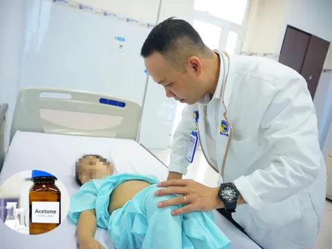 Cảnh báo ngộ độc aceton ở trẻ nhỏ: Nguy hiểm từ vật dụng quen thuộc