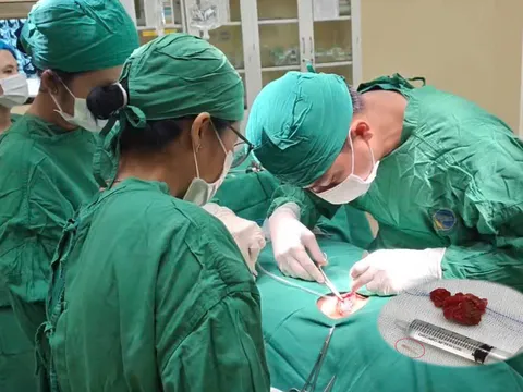 Áp xe cổ do hóc xương cá âm thầm suốt nhiều tháng