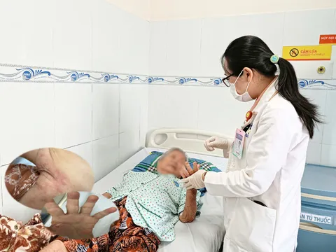 Bệnh ghẻ vẫn phổ biến, dễ lây cho cả gia đình nếu chủ quan