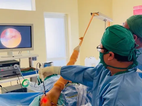 Đau vai kéo dài, người phụ nữ 58 tuổi phục hồi vận động nhờ nội soi khớp vai
