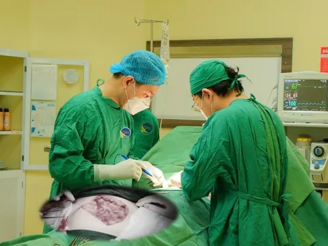 Khối u không đau, người phụ nữ phát hiện ung thư vú khi đi khám