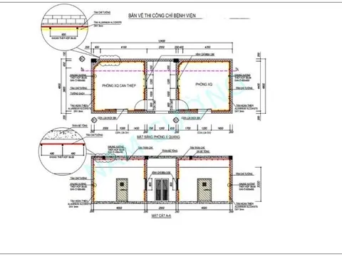 Những rủi ro trong thi công phòng X-quang và yêu cầu an toàn bức xạ trong cơ sở y tế