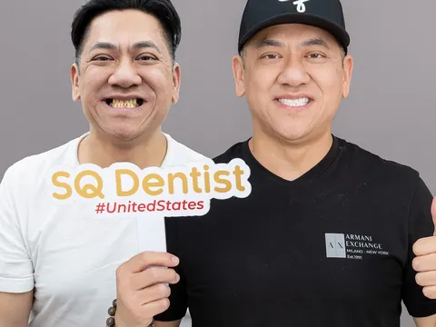 Implant Hàn Quốc, Mỹ Hay Thụy Sĩ? So sánh chi tiết các loại trụ Implant phổ biến hiện nay