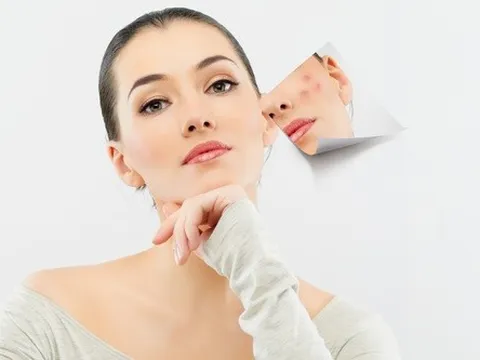 Sau khi mụn giảm, vì sao nhiều người vẫn gặp tình trạng da yếu và dễ tái phát?