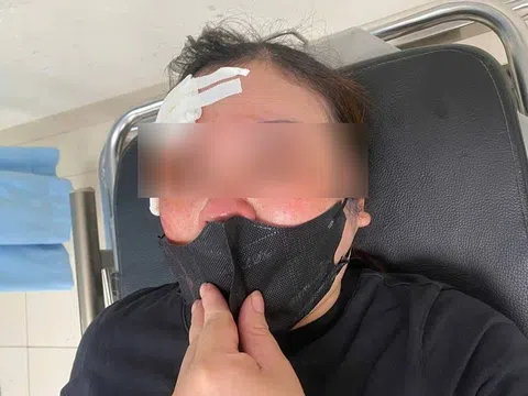 Người phụ nữ "tố" bị tài xế bán tải hành hung giữa phố ở Hà Nội: Công an vào cuộc xác minh
