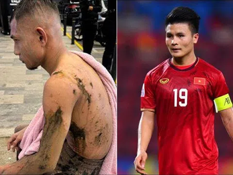 Trước thềm đấu ĐT Việt Nam, 'Ronaldo Malaysia' tái xuất với diện mạo khó tin sau khi bị tạt axit