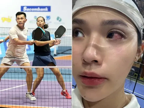 Hot girl pickleball khóc thét khi bị đối thủ nam đánh bóng vào mắt, CĐM bùng nổ tranh cãi