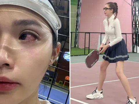 Bị đối thủ nam cố tình đánh bóng pickleball trúng mặt, dàn hot girl đồng lòng nói thẳng cách xử lý