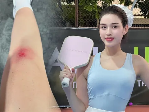 Hoa hậu Đỗ Thị Hà gặp sự cố trên sân pickleball, hài hước chia sẻ về trải nghiệm đáng nhớ