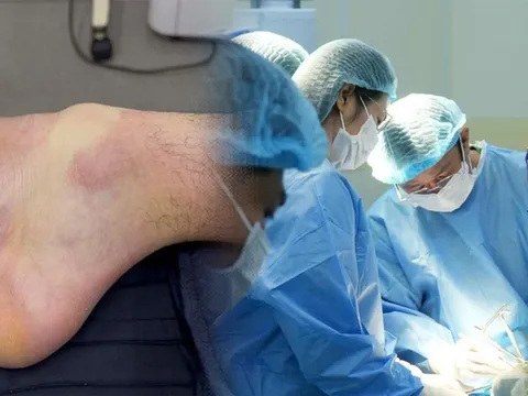 Nam thanh niên 32 tuổi dính chấn thương khi chơi pickleball, kết quả chụp MRI gây ngỡ ngàng