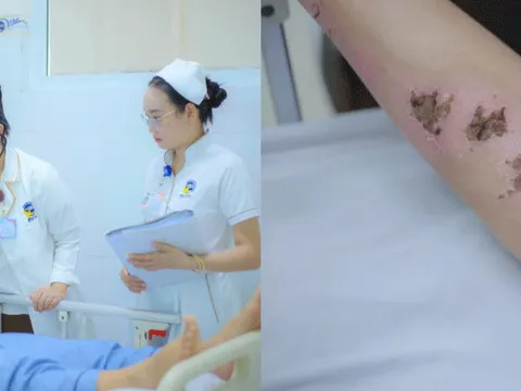 Tình hình hiện tại của cô gái bị sét đánh dẫn đến xuất huyết não? Bác sĩ chỉ cách tránh sét khi trời giông