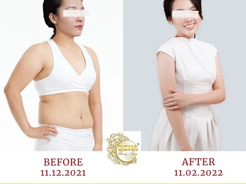 Thẩm mỹ viện giảm béo uy tín tại Gia Lai